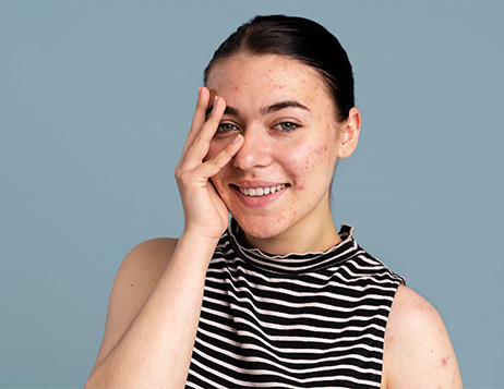 BEAUTY PHOTO RETOUCHING BEFORE